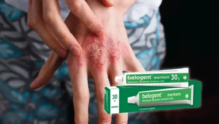 Belogent krem ne işe yarar