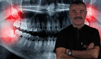 Yirmilik Dişler İhmale Gelmiyor! Uzmanı Uyardı: Gülüşünüz Bozulabilir