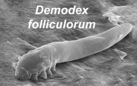 Gözde yanma, sulanma ve kaşıntı varsa Demodex Parazitine dikkat ! Gözde yanma, sulanma ve kaşıntı varsa Demodex Parazitine dikkat !